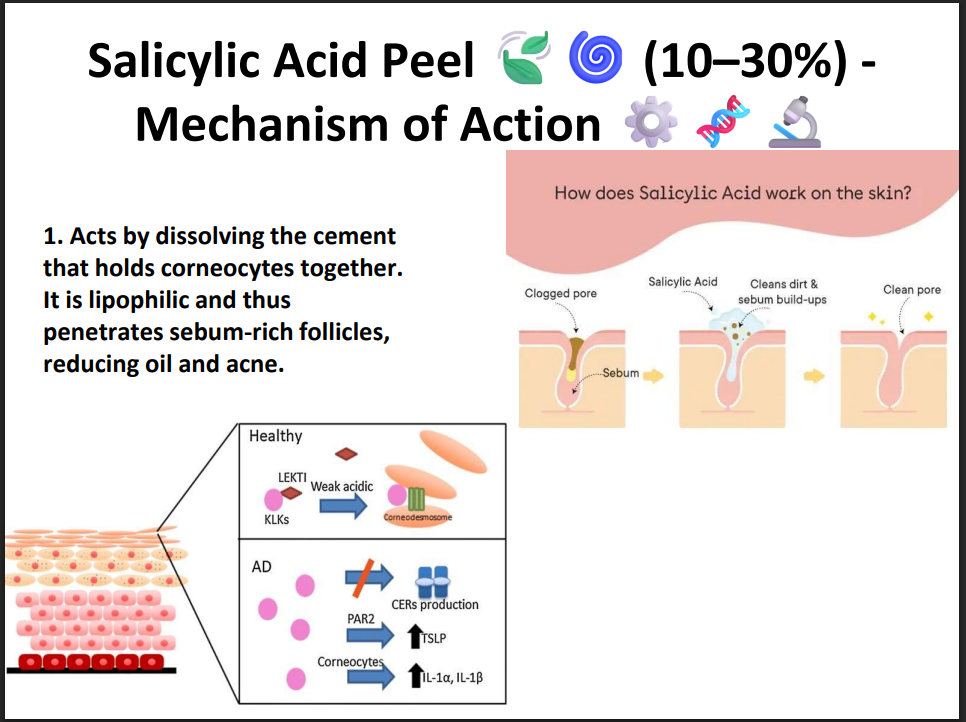 Salicylic Acid Peeling Solution 30% – Professional BHA Chemical Peel for Acne, Oily Skin, Blackheads & Pore Cleansing