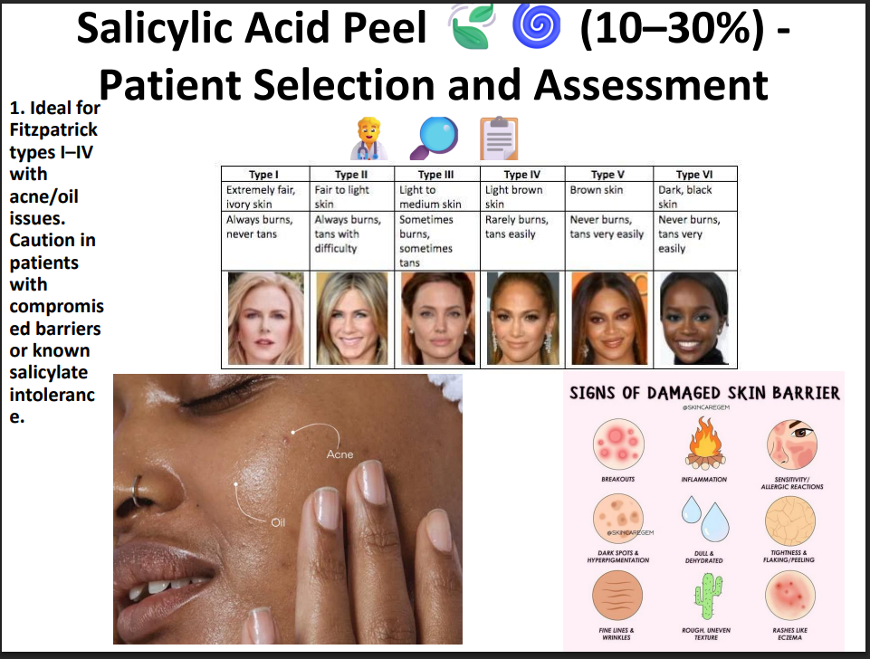 Salicylic Acid Peeling Solution 30% – Professional BHA Chemical Peel for Acne, Oily Skin, Blackheads & Pore Cleansing