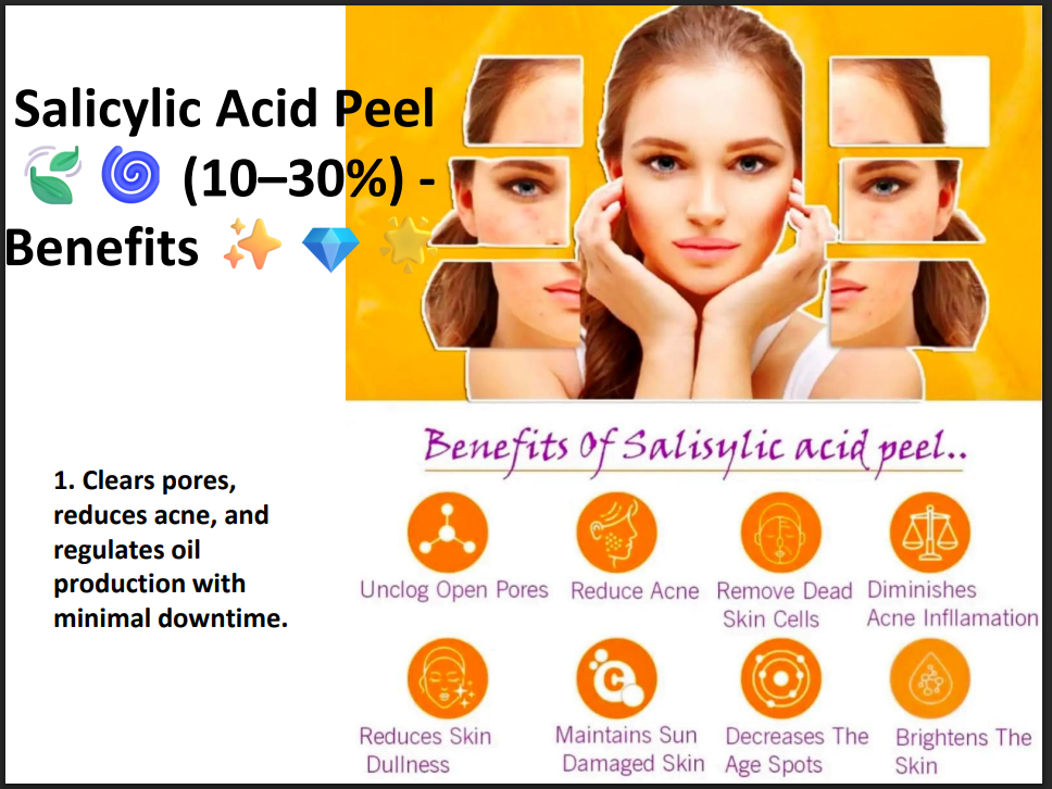Salicylic Acid Peeling Solution 30% – Professional BHA Chemical Peel for Acne, Oily Skin, Blackheads & Pore Cleansing
