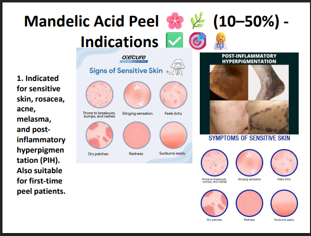 Mandelic Acid Peeling Solution 50% – Professional AHA Chemical Peel for Brightening, Pigmentation, Acne Marks & Sensitive Skin