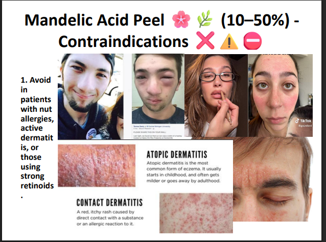Mandelic Acid Peeling Solution 50% – Professional AHA Chemical Peel for Brightening, Pigmentation, Acne Marks & Sensitive Skin