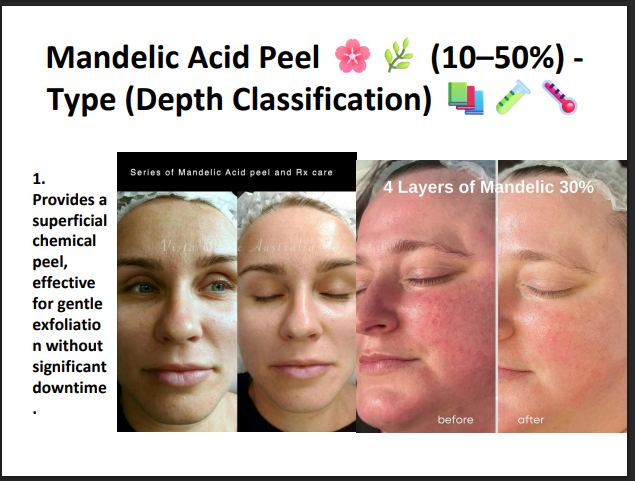 Mandelic Acid Peeling Solution 50% – Professional AHA Chemical Peel for Brightening, Pigmentation, Acne Marks & Sensitive Skin