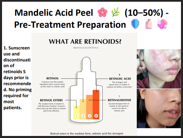 Mandelic Acid Peeling Solution 50% – Professional AHA Chemical Peel for Brightening, Pigmentation, Acne Marks & Sensitive Skin