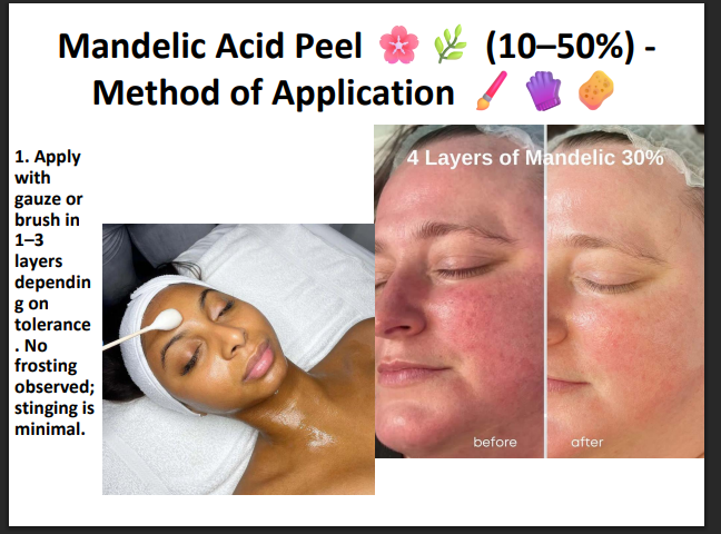 Mandelic Acid Peeling Solution 50% – Professional AHA Chemical Peel for Brightening, Pigmentation, Acne Marks & Sensitive Skin
