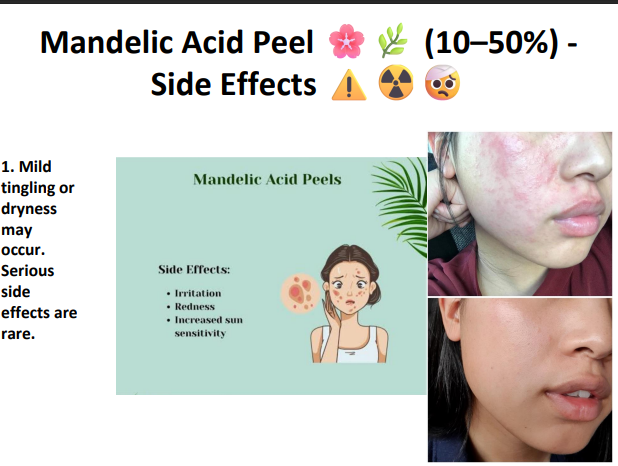 Mandelic Acid Peeling Solution 50% – Professional AHA Chemical Peel for Brightening, Pigmentation, Acne Marks & Sensitive Skin