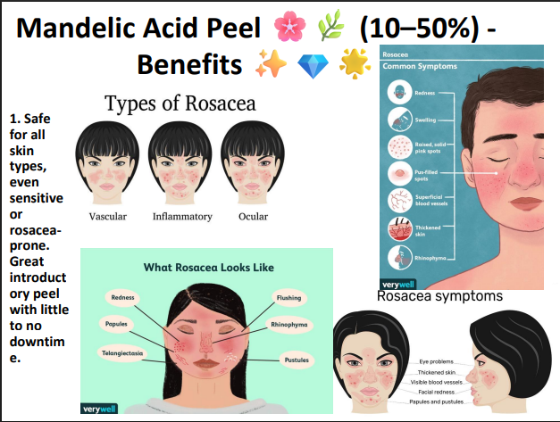 Mandelic Acid Peeling Solution 50% – Professional AHA Chemical Peel for Brightening, Pigmentation, Acne Marks & Sensitive Skin