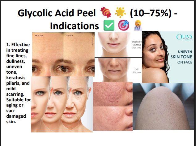 Glycolic Acid Peeling Solution 75% – Professional AHA Chemical Peel for Deep Exfoliation, Pigmentation, Acne Marks & Skin Resurfacing