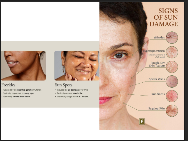 Glycolic Acid Peeling Solution 75% – Professional AHA Chemical Peel for Deep Exfoliation, Pigmentation, Acne Marks & Skin Resurfacing