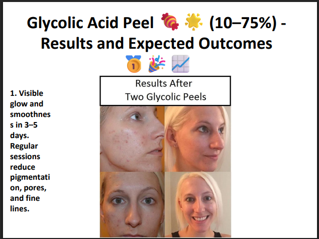 Glycolic Acid Peeling Solution 75% – Professional AHA Chemical Peel for Deep Exfoliation, Pigmentation, Acne Marks & Skin Resurfacing
