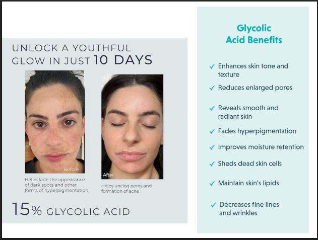 Glycolic Acid Peeling Solution 75% – Professional AHA Chemical Peel for Deep Exfoliation, Pigmentation, Acne Marks & Skin Resurfacing