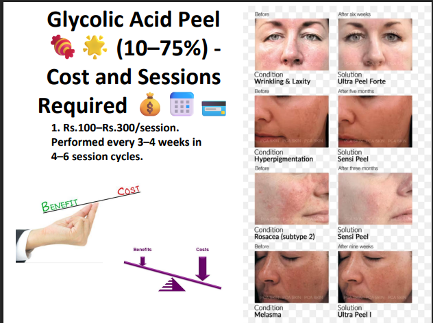 Glycolic Acid Peeling Solution 75% – Professional AHA Chemical Peel for Deep Exfoliation, Pigmentation, Acne Marks & Skin Resurfacing