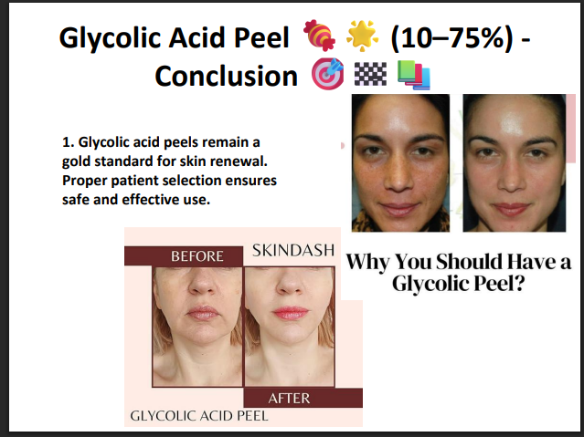 Glycolic Acid Peeling Solution 75% – Professional AHA Chemical Peel for Deep Exfoliation, Pigmentation, Acne Marks & Skin Resurfacing