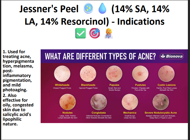 Jessner’s Peeling Solution (14% SA + 14% LA + 14% Resorcinol) – Professional Combination Chemical Peel for Acne, Pigmentation & Skin Resurfacing