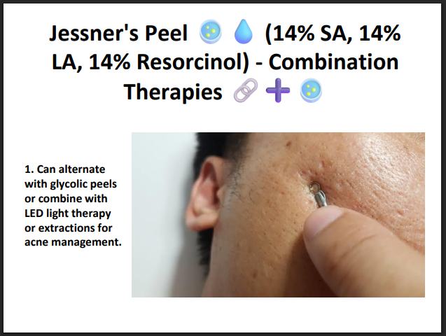 Jessner’s Peeling Solution (14% SA + 14% LA + 14% Resorcinol) – Professional Combination Chemical Peel for Acne, Pigmentation & Skin Resurfacing