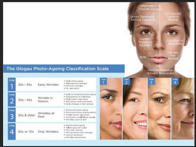 Modified Jessner’s Peeling Solution (14% SA + 14% LA + 14% Resorcinol + 5% Citric Acid) – Professional Peel for Pigmentation, Acne Marks & Brightening