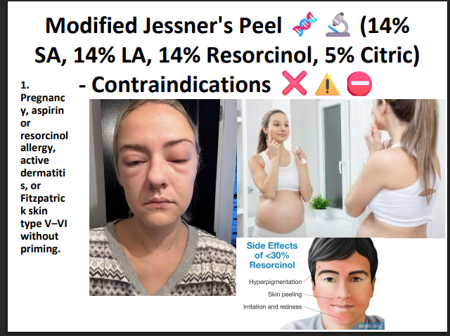 Modified Jessner’s Peeling Solution (14% SA + 14% LA + 14% Resorcinol + 5% Citric Acid) – Professional Peel for Pigmentation, Acne Marks & Brightening