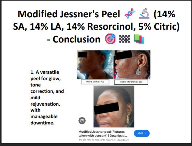 Modified Jessner’s Peeling Solution (14% SA + 14% LA + 14% Resorcinol + 5% Citric Acid) – Professional Peel for Pigmentation, Acne Marks & Brightening