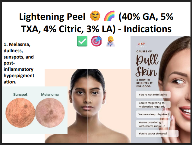 Lightening Peel (40% Glycolic Acid + 5% TXA + 4% Citric Acid + 3% Lactic Acid) – Professional Brightening Peel for Pigmentation & Uneven Skin Tone