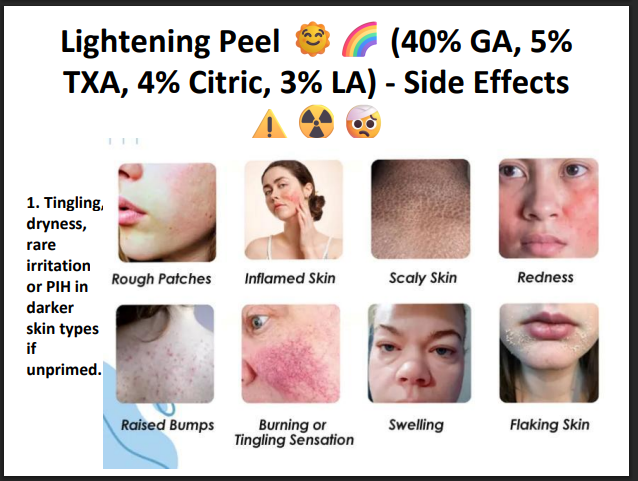 Lightening Peel (40% Glycolic Acid + 5% TXA + 4% Citric Acid + 3% Lactic Acid) – Professional Brightening Peel for Pigmentation & Uneven Skin Tone