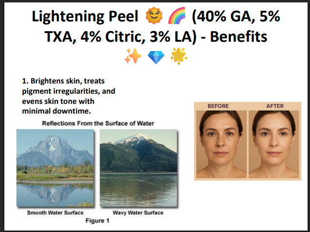 Lightening Peel (40% Glycolic Acid + 5% TXA + 4% Citric Acid + 3% Lactic Acid) – Professional Brightening Peel for Pigmentation & Uneven Skin Tone