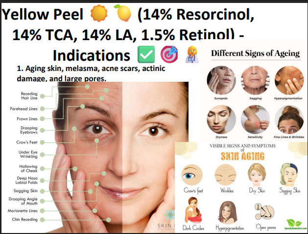 Lightening Peel (40% Glycolic Acid + 5% TXA + 4% Citric Acid + 3% Lactic Acid) – Professional Brightening Peel for Pigmentation & Uneven Skin Tone