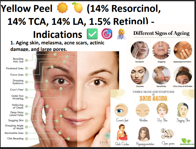 yellow peel (14% resorcinol,14% tca ,114% ls 1.5 Retinol)