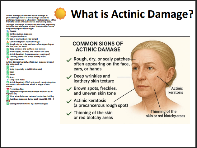 yellow peel (14% resorcinol,14% tca ,114% ls 1.5 Retinol)
