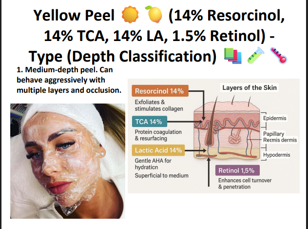 yellow peel (14% resorcinol,14% tca ,114% ls 1.5 Retinol)