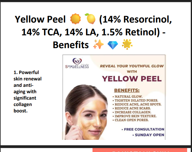 yellow peel (14% resorcinol,14% tca ,114% ls 1.5 Retinol)
