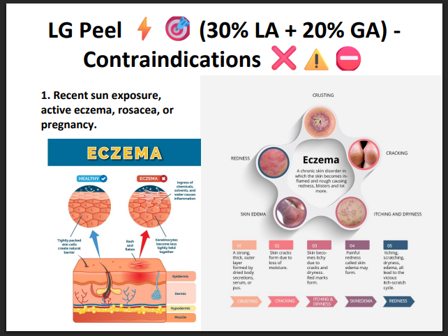 LG Peel (30% Lactic Acid + 20% Glycolic Acid) – Professional Hydrating & Exfoliating Chemical Peel for Glow, Texture & Uneven Skin Tone