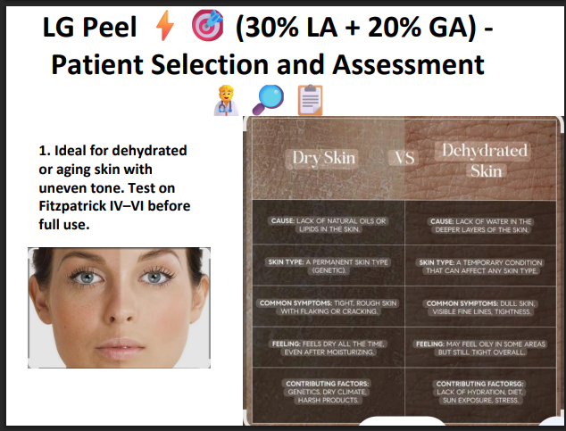 LG Peel (30% Lactic Acid + 20% Glycolic Acid) – Professional Hydrating & Exfoliating Chemical Peel for Glow, Texture & Uneven Skin Tone