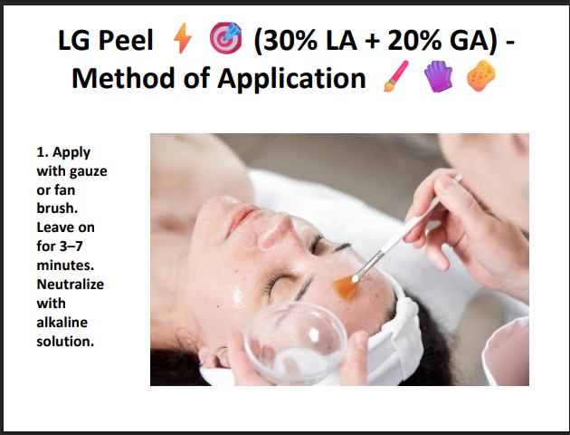 LG Peel (30% Lactic Acid + 20% Glycolic Acid) – Professional Hydrating & Exfoliating Chemical Peel for Glow, Texture & Uneven Skin Tone