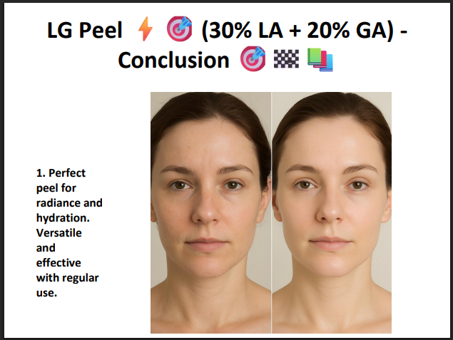 LG Peel (30% Lactic Acid + 20% Glycolic Acid) – Professional Hydrating & Exfoliating Chemical Peel for Glow, Texture & Uneven Skin Tone
