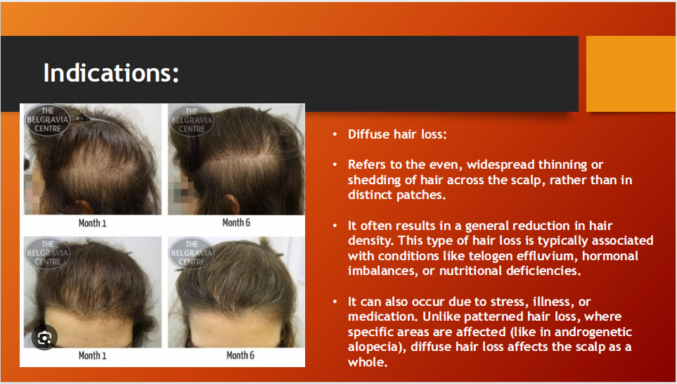 DHL Hair Lotion – Hair Regrowth Formula for Men & Women (70ml)