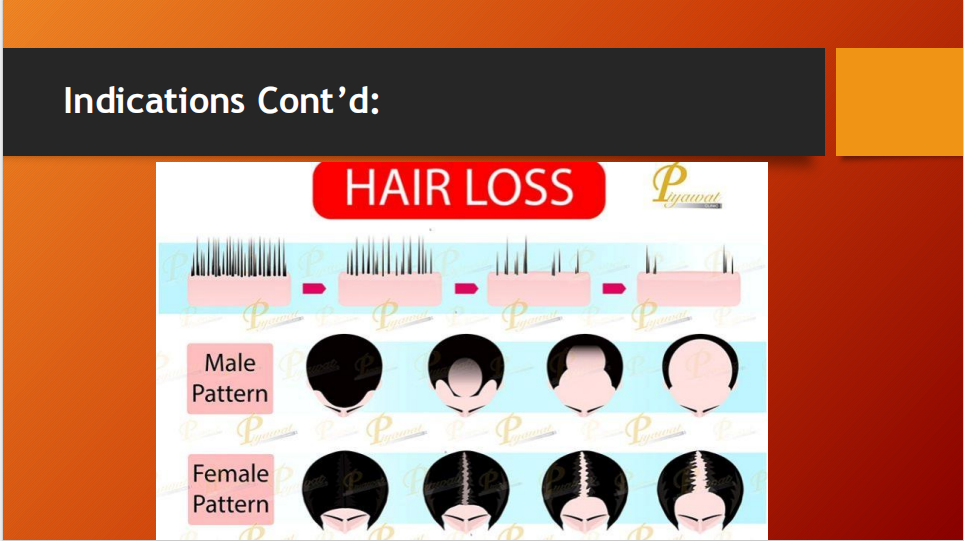 Grow Max Plus 5% Minoxidil Hair Spray – Active Hair Growth Solution (70ml)