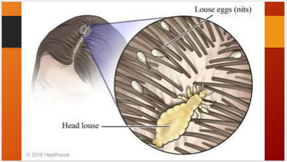 Permicite Oil 2% Permethrin – Anti-Lice Hair Treatment (60ml)