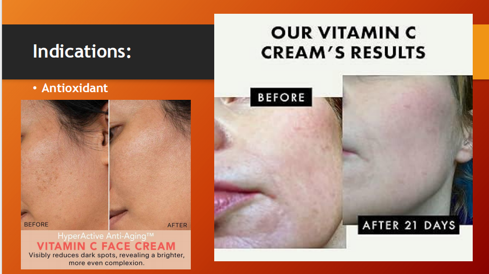 Vite C Cream – Vitamin C 10% in Aqueous Cream (60g)