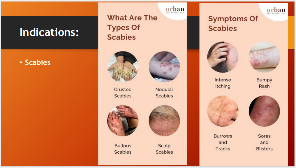 Permicite Lotion 5% – Topical Scabies & Skin Parasite Care Solution