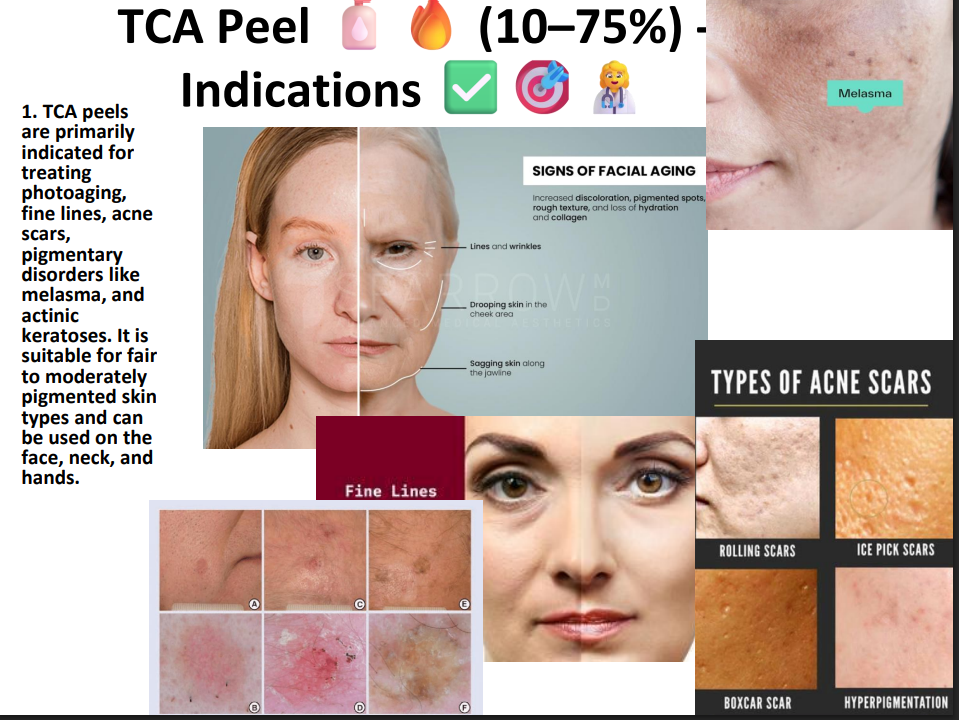 TCA Peeling Solution 75% – Professional Grade Chemical Peel for Deep Exfoliation, Skin Resurfacing & Pigmentation
