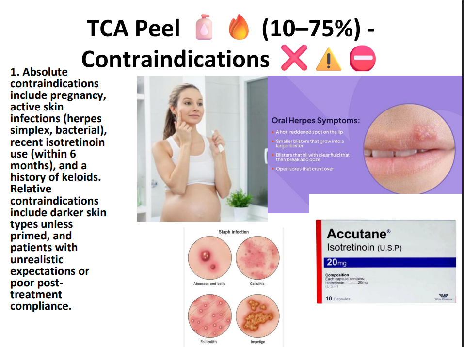 TCA Peeling Solution 75% – Professional Grade Chemical Peel for Deep Exfoliation, Skin Resurfacing & Pigmentation
