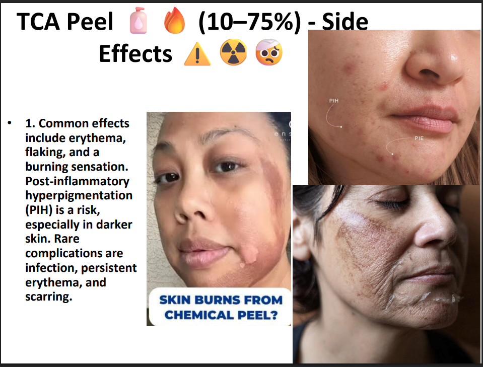 TCA Peeling Solution 75% – Professional Grade Chemical Peel for Deep Exfoliation, Skin Resurfacing & Pigmentation