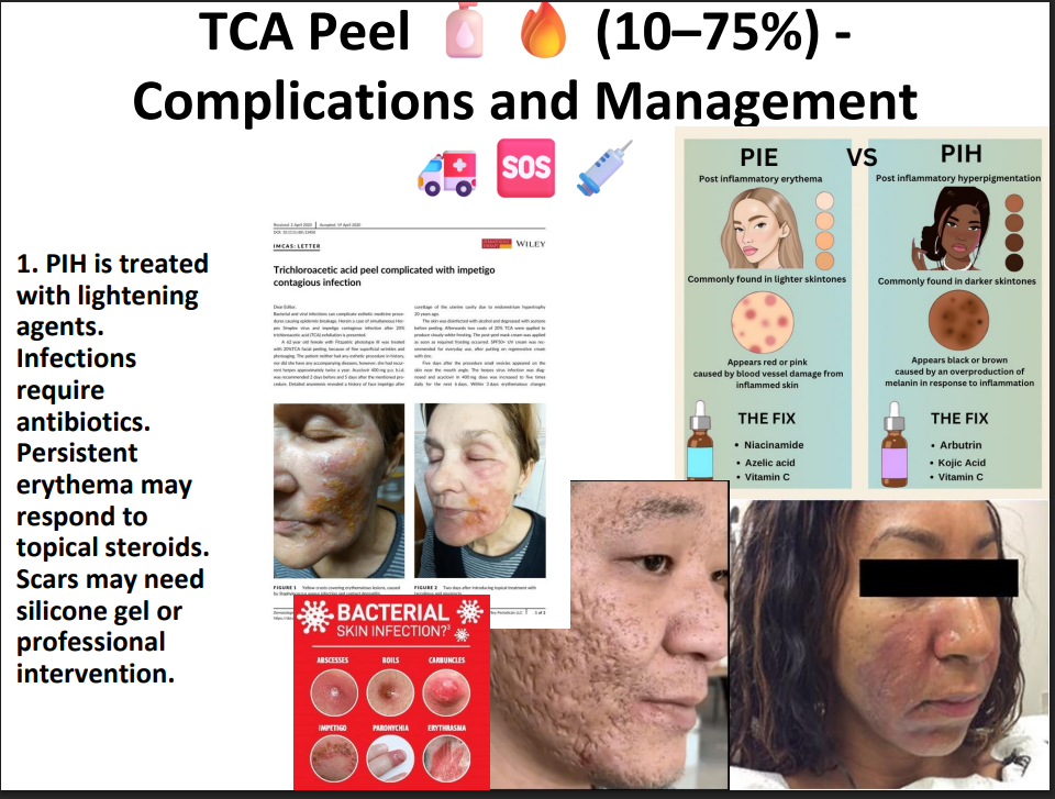 TCA Peeling Solution 75% – Professional Grade Chemical Peel for Deep Exfoliation, Skin Resurfacing & Pigmentation