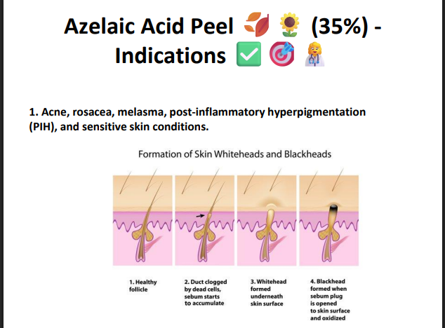 Azelaic Acid Peeling Solution 35% – Professional Peel for Acne, Sensitive Skin, Redness & Pigmentation Correction